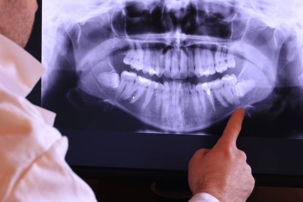 Best Broken or Cracked Tooth Emergency Dentist in Gastonville, PA